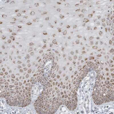 Immunohistochemistry-Paraffin: FNDC1 Antibody [NBP1-88800] - Staining of human cervix shows moderate granular cytoplasmic positivity in squamous epithelial cells.