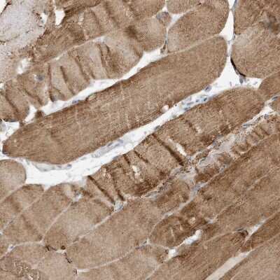 Immunohistochemistry-Paraffin: FNDC1 Antibody [NBP1-88800] - Staining of human skeletal muscle shows moderate cytoplasmic positivity in myocytes.