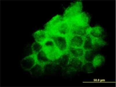 Immunocytochemistry/Immunofluorescence: FNDC3A Antibody (2H4) [H00022862-M01] - Analysis of monoclonal antibody to FNDC3A on A-431 cell. Antibody concentration 10 ug/ml.