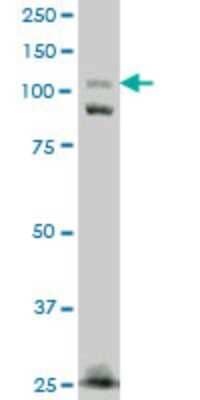 Western Blot: FNDC3A Antibody (2H4) [H00022862-M01] - FNDC3A monoclonal antibody (M01), clone 2H4 Analysis of FNDC3A expression in A-431.