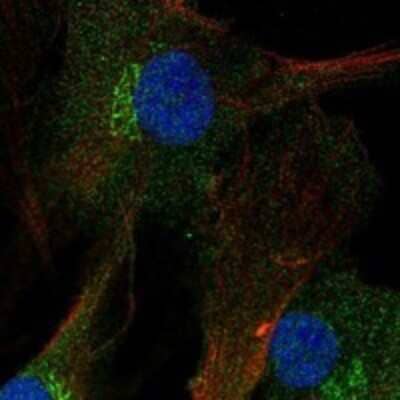 Immunocytochemistry/Immunofluorescence: FNDC3A Antibody [NBP3-17849] - Staining of human cell line BJ shows localization to nucleoplasm, cytosol & the Golgi apparatus.