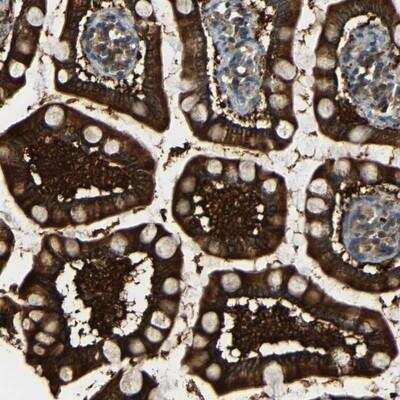 Immunohistochemistry: FNDC3A Antibody [NBP1-88810] - Staining of human small intestine shows strong cytoplasmic positivity in glandular cells.