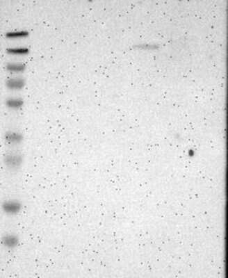 Western Blot: FNDC3A Antibody [NBP3-17849] - Lane 1: Marker [kDa] 230, 130, 95, 72, 56, 36, 28, 17, 11;   Lane 2: RT4;   Lane 3: U-251 MG;   Lane 4: Human Plasma;   Lane 5: Liver;   Lane 6: Tonsil