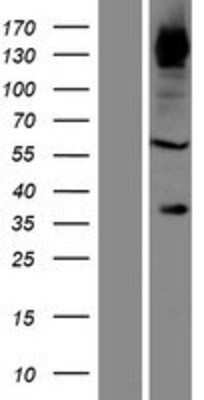Western Blot: FNDC3B Overexpression Lysate (Adult Normal) [NBP2-06412] Left-Empty vector transfected control cell lysate (HEK293 cell lysate); Right -Over-expression Lysate for FNDC3B.