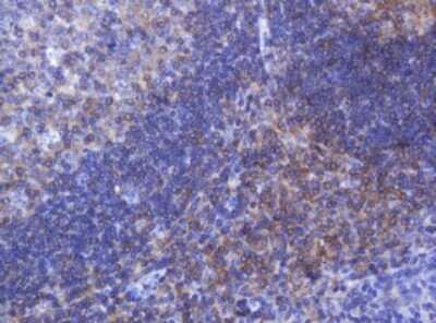 Immunohistochemistry: FNDC4 Antibody (1B7) [NBP2-45691] - Analysis of Human tonsil tissue. (Heat-induced epitope retrieval by 10mM citric buffer, pH6.0, 120C for 3min)