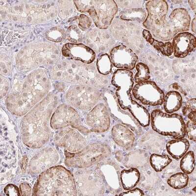 Immunohistochemistry-Paraffin: FNDC4 Antibody [NBP2-49397] - Staining of human kidney shows strong cytoplasmic and membranous positivity in subset of cells in tubules.