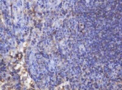 Immunohistochemistry: FNDC4 Antibody (OTI1B7) - Azide and BSA Free [NBP2-72151] - Analysis of Human lymph node tissue. (Heat-induced epitope retrieval by 10mM citric buffer, pH6.0, 120C for 3min)