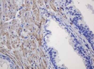Immunohistochemistry: FNDC4 Antibody (OTI1B7) - Azide and BSA Free [NBP2-72151] - Analysis of Human prostate tissue within the normal limits using FNDC4 mouse monoclonal antibody. (Heat-induced epitope retrieval by 10mM citric buffer, pH6.0, 120C for 3min)