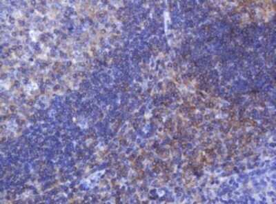 Immunohistochemistry: FNDC4 Antibody (OTI1B7) - Azide and BSA Free [NBP2-72151] - Analysis of Human tonsil tissue. (Heat-induced epitope retrieval by 10mM citric buffer, pH6.0, 120C for 3min)