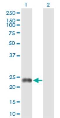 Western Blot: FNDC4 Antibody [H00064838-D01P] - Analysis of FNDC4 expression in transfected 293T cell line by FNDC4 polyclonal antibody.Lane 1: FNDC4 transfected lysate(25.20 KDa).Lane 2: Non-transfected lysate.