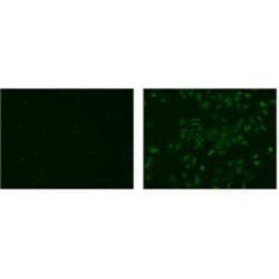 Immunocytochemistry/Immunofluorescence: FNDC6 Antibody (20RNTC) [NBP2-00466] - Immunofluorescent microscopy of fixed and permeabilized A375 cells using 10 ug/ml of Anti-Human/Mouse IL-20 Receptor 2 (IL-20Rb) Purified (right) or Rat IgG2a kappa Isotype Control Purified (NBP1-43321) (left) followed by Anti-Rat IgG Biotin and then Streptavidin FITC.