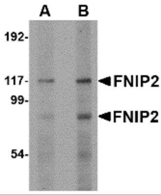 Western Blot: FNIP2 Antibody [NBP2-81934] - Analysis of FNIP2 in rat skeletal muscle lysate with FNIP2 antibody at (A) 1 and (B) 2 ug/ml.