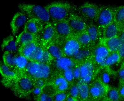 Immunocytochemistry/Immunofluorescence: FNTB Antibody (SC06-44) [NBP2-67644] - Staining FNTB in JAR cells (green). The nuclear counter stain is DAPI (blue). Cells were fixed in paraformaldehyde, permeabilised with 0.25% Triton X100/PBS.