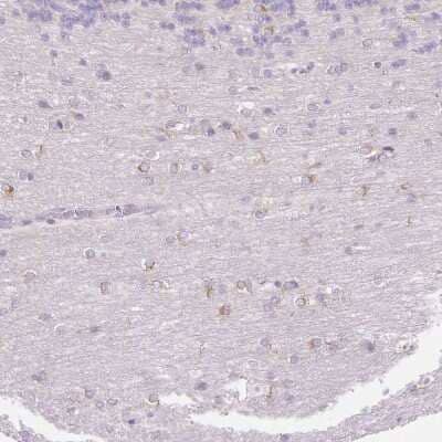 Immunohistochemistry-Paraffin: FOCAD Antibody [NBP2-49163] - Staining of human Cerebellum shows weak cytoplasmic positivity in neuronal cells.