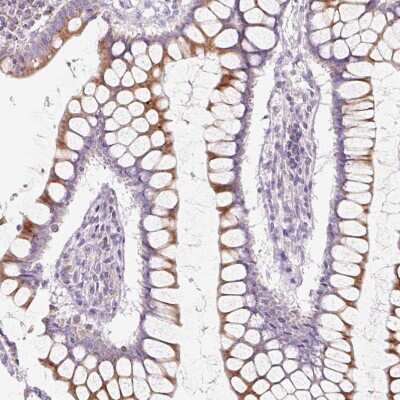 Immunohistochemistry-Paraffin: FOCAD Antibody [NBP2-49163] - Staining of human Colon shows moderate cytoplasmic and membranous positivity in glandular cells.