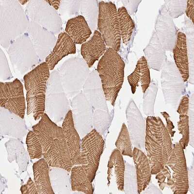 Immunohistochemistry-Paraffin: FOCAD Antibody [NBP2-49163] - Staining of human Skeletal muscle shows strong cytoplasmic positivity in myocytes.