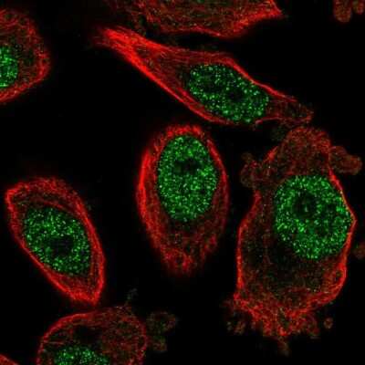 Immunocytochemistry/Immunofluorescence: FOG2 Antibody [NBP1-91909] - Immunofluorescent staining of human cell line PC-3 shows localization to nucleoplasm. Antibody staining is shown in green.