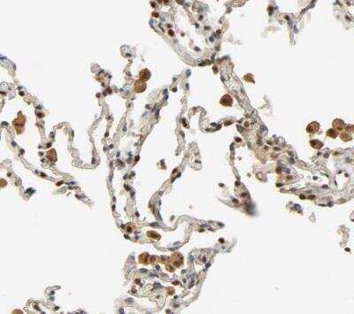 Immunohistochemistry-Paraffin: FOG2 Antibody [NBP1-91909] - Staining of human lung shows strong nuclear postivity in pneumocytes.
