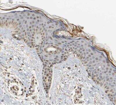 Immunohistochemistry-Paraffin: FOG2 Antibody [NBP1-91909] - Staining of human skin shows moderate nuclear positivity in squamous epithelial cells.