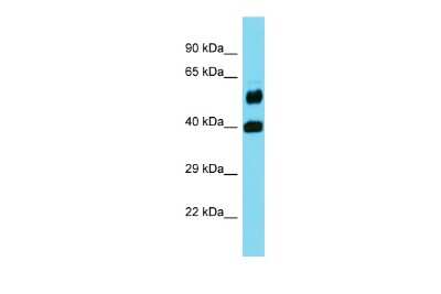 Western Blot: FOLH1B Antibody [NBP3-09721] - Western blot analysis of FOLH1B in Fetal Brain lysates. Antibody dilution at 1.0ug/ml