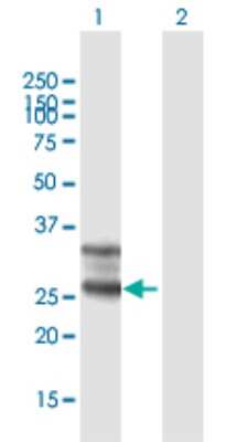 Western Blot: FOLR1 Antibody [H00002348-B01P] - Analysis of FOLR1 expression in transfected 293T cell line by FOLR1 polyclonal antibody.  Lane 1: FOLR1 transfected lysate(28.38 KDa). Lane 2: Non-transfected lysate.