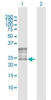 Western Blot: FOLR1 Antibody [H00002348-D01P] - Analysis of FOLR1 expression in transfected 293T cell line by FOLR1 polyclonal antibody.Lane 1: FOLR1 transfected lysate(29.80 KDa).Lane 2: Non-transfected lysate.