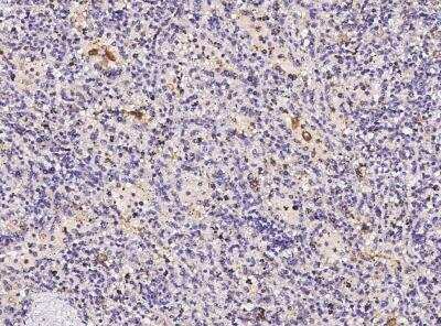 Immunohistochemistry-Paraffin: FOLR2 Antibody (001) [NBP2-89846] -  Staining of human FOLR2 in human spleen with rabbit monoclonal antibody at 1:5000 dilution.