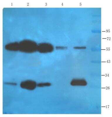 Western Blot: FOLR2 Antibody (CL10) [NBP2-81079] - Mouse heart (lane 1), mouse lung (lane 2), mouse pancreas (lane 3), mouse testis (lane 4) and rat ovary (lane 5) samples were resolved on a 12% SDS PAGE gel and blots probed with NBP2-81079 at 1.5 ug/ml before being detected by a secondary antibody. Bands corresponding to the expected 29 kDa folate receptor protein as well as dimers thereof were detected.