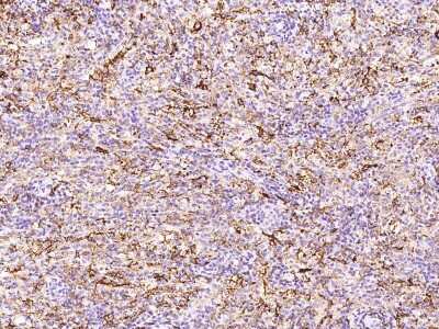 Immunohistochemistry-Paraffin: FOLR2 Antibody [NBP2-99741] - Immunochemical staining of human FOLR2 in human spleen with rabbit polyclonal antibody at 1:1000 dilution, formalin-fixed paraffin embedded sections.