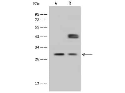 Western Blot: FOLR2 Antibody [NBP2-99741] - Anti-FOLR2 rabbit polyclonal antibody at 1:500 dilution. Lane A: HeLa Whole Cell Lysate Lane B: MCF-7 Whole Cell Lysate Lysates/proteins at 30 ug per lane. Secondary Goat Anti-Rabbit IgG (H+L)/HRP at 1/10000 dilution. Developed using the ECL technique. Performed under reducing conditions. Predicted band size: 29 kDa. Observed band size: 29 kDa (We are unsure as to the identity of these extra bands).