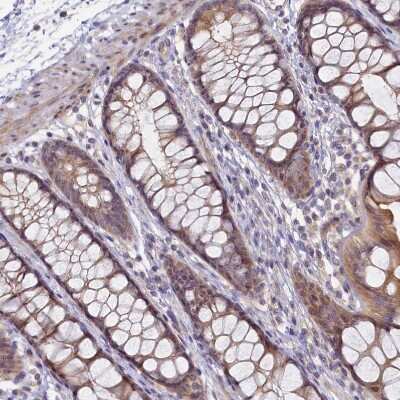 Immunohistochemistry-Paraffin: FOPNL Antibody [NBP1-84109] - Staining of human rectum shows weak to moderate cytoplasmic positivity in glandular cells.