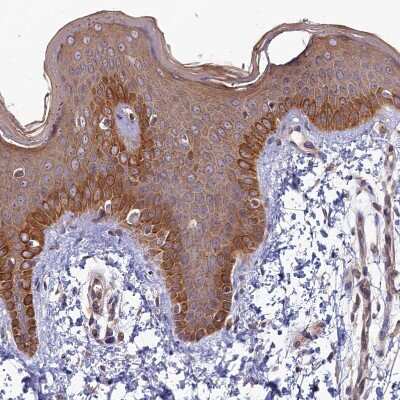 Immunohistochemistry-Paraffin: FOPNL Antibody [NBP1-84109] - Staining of human skin shows moderate cytoplasmic positivity in squamous epithelial cells.