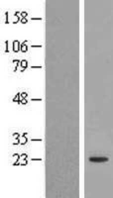 Western Blot: FOPNL Overexpression Lysate (Adult Normal) [NBL1-08223] Left-Empty vector transfected control cell lysate (HEK293 cell lysate); Right -Over-expression Lysate for FOPNL.