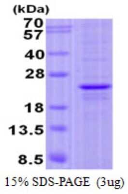 SDS-PAGE Recombinant Human FOPNL His Protein