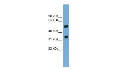 Western Blot: FOXA3 Antibody [NBP2-87462] - WB Suggested Anti-Foxa3 Antibody Titration: 0.2-1 ug/ml. ELISA Titer: 1:312500. Positive Control: Mouse Brain