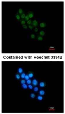 Immunocytochemistry/Immunofluorescence: FOXB1 Antibody [NBP2-16517] - Analysis of paraformaldehyde-fixed HepG2, using antibody at 1:200 dilution.