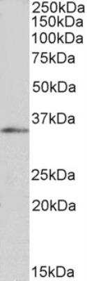 Western Blot: FOXB1 Antibody [NB100-1267] - Staining of HepG2 nuclear lysate (35ug protein in RIPA buffer). Primary incubation was 1 hour. 