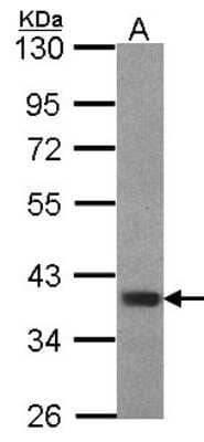Western Blot: FOXB1 Antibody [NBP2-16517] - Sample (30 ug of whole cell lysate) A: Hep G2 10% SDS PAGE gel, diluted at 1:1000.