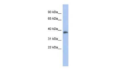 Western Blot: FOXB1 Antibody [NBP2-87463] - WB Suggested Anti-FOXB1 Antibody Titration: 0.2-1 ug/ml. ELISA Titer: 1:62500. Positive Control: Human Spleen