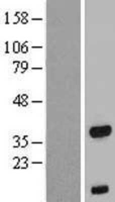 Western Blot: FOXB1 Overexpression Lysate (Adult Normal) [NBP2-07480] Left-Empty vector transfected control cell lysate (HEK293 cell lysate); Right -Over-expression Lysate for FOXB1.