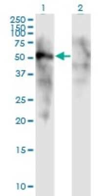 Western Blot: FOXD1 Antibody (2C10) [H00002297-M01] - Analysis of FOXD1 expression in transfected 293T cell line by FOXD1 monoclonal antibody (M01), clone 2C10.Lane 1: FOXD1 transfected lysate (Predicted MW: 51.15 KDa).Lane 2: Non-transfected lysate.