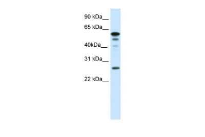 Western Blot: FOXD1 Antibody [NBP3-10404] - Western blot analysis using NBP3-10404 on Mouse SP2/0 as a positive control. Antibody Titration: 0.0625ug/ml