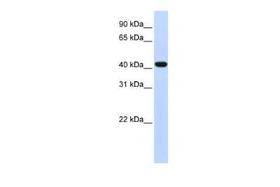 Western Blot: FOXD1 Antibody [NBP3-10960] - Western blot analysis using NBP3-10960 on Human Lung  as a positive control. Antibody Titration: 0.2-1 ug/ml