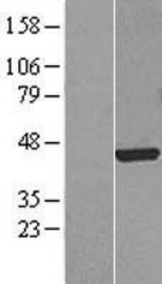 Western Blot: FOXF1 Overexpression Lysate (Adult Normal) [NBL1-10803] Left-Empty vector transfected control cell lysate (HEK293 cell lysate); Right -Over-expression Lysate for FOXF1.