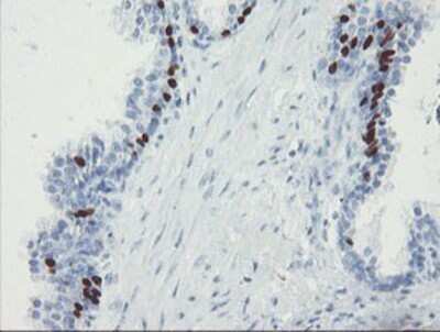 Immunohistochemistry-Paraffin: FOXI1 Antibody (1D4) [NBP2-03868] - Staining of paraffin-embedded Human prostate tissue using anti-FOXI1 mouse monoclonal antibody.