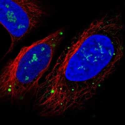 <b>Orthogonal Strategies Validation. </b>Immunocytochemistry/Immunofluorescence: FOXI1 Antibody [NBP2-49660] - Staining of human cell line U-2 OS shows localization to nucleoli & vesicles. Antibody staining is shown in green.