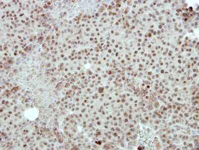 Immunohistochemistry-Paraffin: FOXI1 Antibody [NBP2-16518] - Huh7 xenograft, using FOXI1 antibody at 1:500 dilution. Antigen Retrieval: Citrate buffer, pH 6.0, 15 min