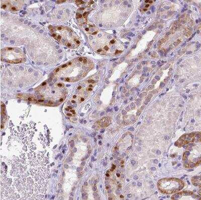 Immunohistochemistry-Paraffin: FOXI1 Antibody [NBP2-49660] -  Staining of human kidney shows moderate nuclear positivity in a subset of cells in tubules.