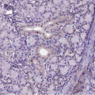 <b>Orthogonal Strategies Validation. </b>Immunohistochemistry-Paraffin: FOXI1 Antibody [NBP2-49660] -  Staining of human salivary gland shows moderate nuclear positivity in a subset of glandular cells.