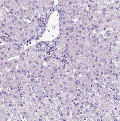 Immunohistochemistry-Paraffin: FOXI1 Antibody [NBP2-49660] - Staining of human liver shows no positivity in hepatocytes as expected.